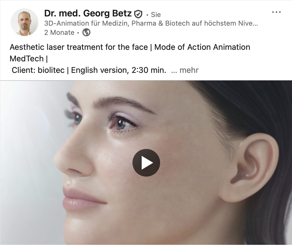MoA-Animation: Ästhetische Laserbehandlung des Gesichts